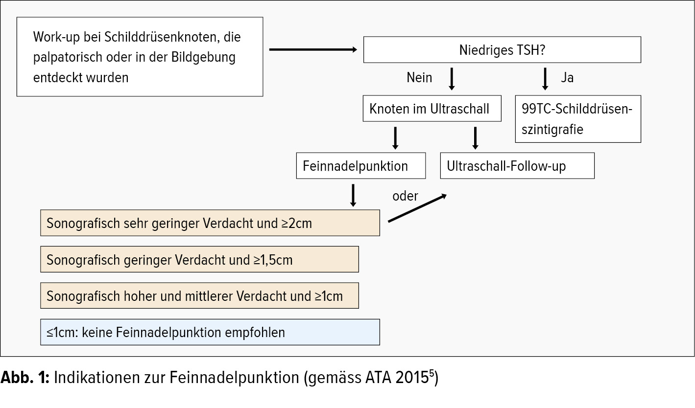 Entdeckt schilddrüse knoten in Schilddrüsenknoten: Ursachen,